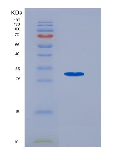 SDS-PAGE analysis of Human PTGS1 (Prostaglandin G/H Synthase 1) - Recombinant Protein, showing >90% purity under 15% SDS-PAGE (Reduced)