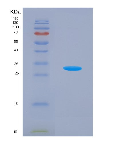 SDS-PAGE analysis of Human Adenosine Monophosphate Deaminase 2 (AMPD2) - Recombinant Protein, showing >90% purity under 15% SDS-PAGE (Reduced)