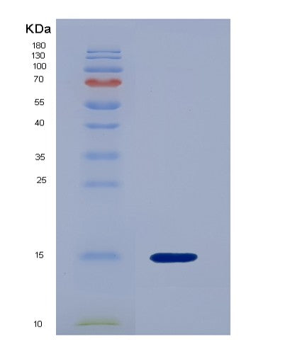 SDS-PAGE analysis of Human P2RY14 (P2Y Purinoceptor 14) - Recombinant Protein, showing >90% purity under 15% SDS-PAGE (Reduced)