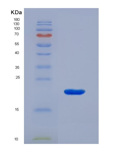 SDS-PAGE analysis of Human HPSE (Heparanase) - Recombinant Protein, showing >90% purity under 15% SDS-PAGE (Reduced)