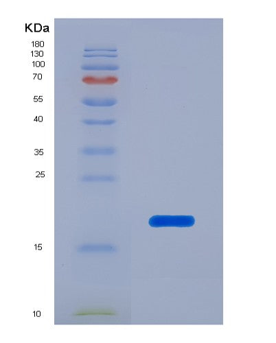 SDS-PAGE analysis of Human APP (Amyloid-Beta Precursor Protein) - Recombinant Protein, showing >90% purity under 15% SDS-PAGE (Reduced)