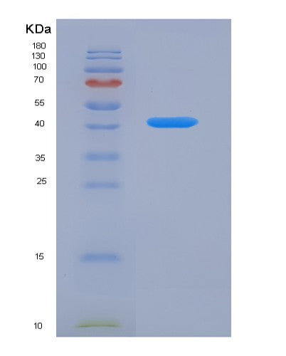 SDS-PAGE analysis of Human TFR2 (Transferrin Receptor Protein 2) - Recombinant Protein, showing >90% purity under 15% SDS-PAGE (Reduced)