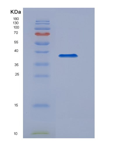 SDS-PAGE analysis of Human TBK1 (Serine/Threonine-Protein Kinase Tbk1) - Recombinant Protein, showing >90% purity under 15% SDS-PAGE (Reduced)
