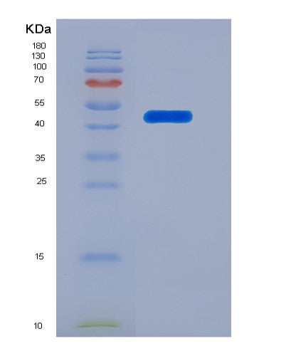 SDS-PAGE analysis of Mouse Ntn1 (Netrin-1) - Recombinant Protein, showing >90% purity under 15% SDS-PAGE (Reduced)