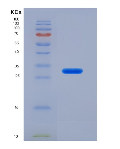 SDS-PAGE analysis of Human LAMC1 (Laminin Subunit Gamma-1) - Recombinant Protein, showing >90% purity under 15% SDS-PAGE (Reduced)
