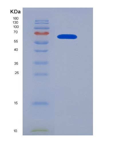 SDS-PAGE analysis of Human CAT (Catalase) - Recombinant Protein, showing >90% purity under 15% SDS-PAGE (Reduced)