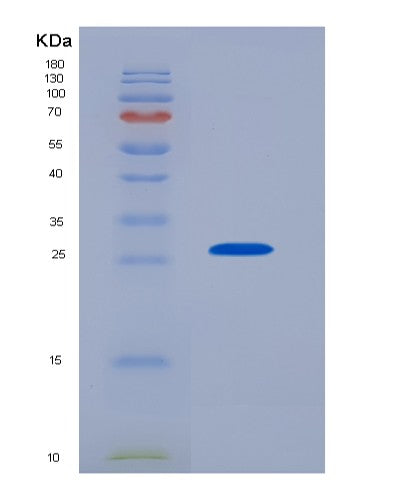 SDS-PAGE analysis of Human FCN1 (Ficolin-1) - Recombinant Protein, showing >90% purity under 15% SDS-PAGE (Reduced)