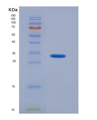 SDS-PAGE analysis of Human AMY2A (Pancreatic Alpha-Amylase) - Recombinant Protein, showing >90% purity under 15% SDS-PAGE (Reduced)