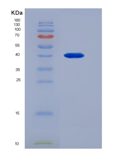 SDS-PAGE analysis of Human Calmegin (CLGN) - Recombinant Protein, showing >90% purity under 15% SDS-PAGE (Reduced)