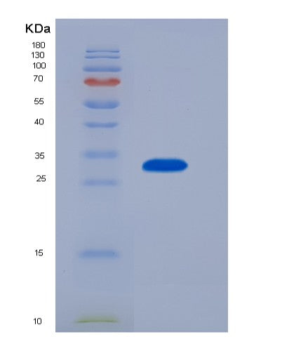 SDS-PAGE analysis of Human IL4I1 (L-Amino-Acid Oxidase) - Recombinant Protein, showing >90% purity under 15% SDS-PAGE (Reduced)