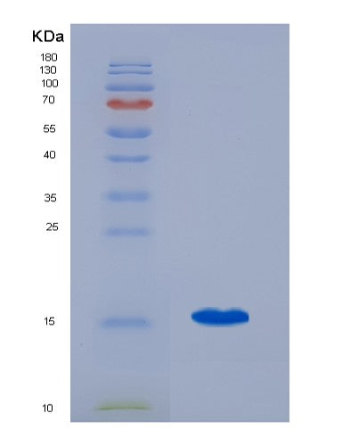 SDS-PAGE analysis of Human ENG (Endoglin) - Recombinant Protein, showing >90% purity under 15% SDS-PAGE (Reduced)
