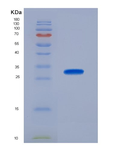 SDS-PAGE analysis of Human MPST (3-Mercaptopyruvate Sulfurtransferase) - Recombinant Protein, showing >90% purity under 15% SDS-PAGE (Reduced)