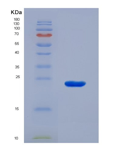 SDS-PAGE analysis of Human APOE (Apolipoprotein E) - Recombinant Protein, showing >90% purity under 15% SDS-PAGE (Reduced)