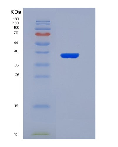 SDS-PAGE analysis of Human MAP2K1 (Dual Specificity Mitogen-Activated Protein Kinase Kinase 1) - Recombinant Protein, showing >90% purity under 15% SDS-PAGE (Reduced)