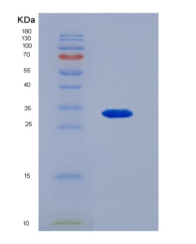 SDS-PAGE analysis of Human XPNPEP2 (Xaa-Pro Aminopeptidase 2) - Recombinant Protein, showing >90% purity under 15% SDS-PAGE (Reduced)