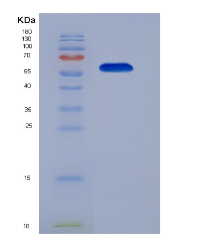 SDS-PAGE analysis of Mouse IQ Motif Containing GTPase Activating 1 (IQGAP1) - Recombinant Protein, showing >90% purity under 15% SDS-PAGE (Reduced)