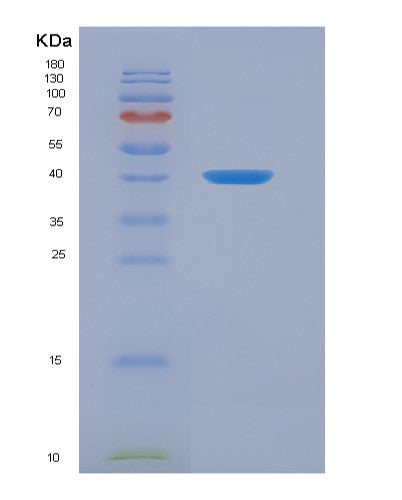 SDS-PAGE analysis of Human CKB (Creatine Kinase B-Type) - Recombinant Protein, showing >90% purity under 15% SDS-PAGE (Reduced)