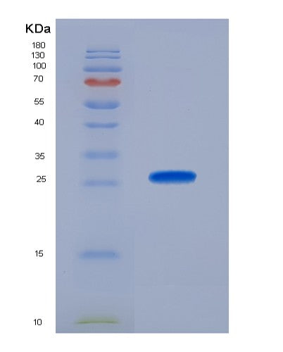 SDS-PAGE analysis of Human GSS (Glutathione Synthetase) - Recombinant Protein, showing >90% purity under 15% SDS-PAGE (Reduced)