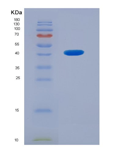 SDS-PAGE analysis of Human PLA2G4D (Cytosolic Phospholipase A2 Delta) - Recombinant Protein, showing >90% purity under 15% SDS-PAGE (Reduced)