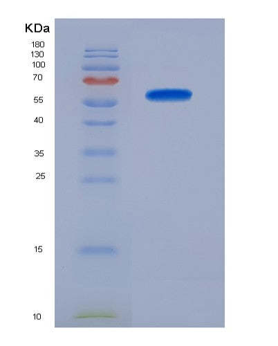 SDS-PAGE analysis of Mouse Tgfbr3 (Transforming Growth Factor Beta Receptor Type 3) - Recombinant Protein, showing >90% purity under 15% SDS-PAGE (Reduced)