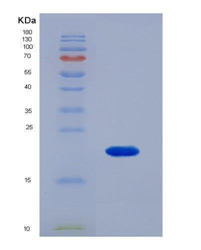 SDS-PAGE analysis of Mouse Ca5a (Carbonic Anhydrase 5A, Mitochondrial) - Recombinant Protein, showing >90% purity under 15% SDS-PAGE (Reduced)