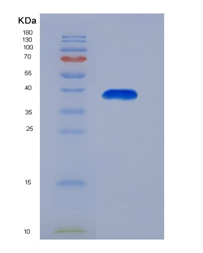 SDS-PAGE analysis of Human NAP1L1 (Nucleosome Assembly Protein 1-Like 1) - Recombinant Protein, showing >90% purity under 15% SDS-PAGE (Reduced)