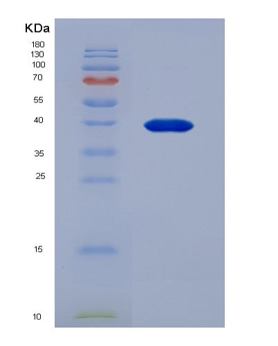 SDS-PAGE analysis of Human TNNT1 (Troponin T, Slow Skeletal Muscle) - Recombinant Protein, showing >90% purity under 15% SDS-PAGE (Reduced)