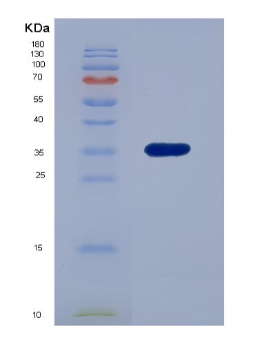 SDS-PAGE analysis of Human RCN2 (Reticulocalbin-2) - Recombinant Protein, showing >90% purity under 15% SDS-PAGE (Reduced)