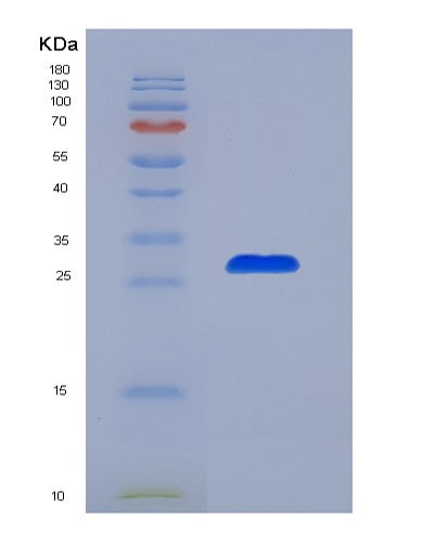 SDS-PAGE analysis of Mouse Tg (Thyroglobulin) - Recombinant Protein, showing >90% purity under 15% SDS-PAGE (Reduced)