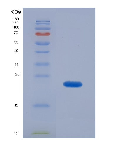 SDS-PAGE analysis of Mouse Ambp (Protein Ambp) - Recombinant Protein, showing >90% purity under 15% SDS-PAGE (Reduced)