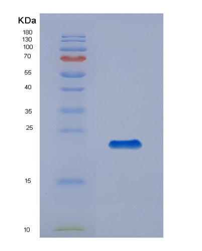 SDS-PAGE analysis of Human IL21R (Interleukin-21 Receptor) - Recombinant Protein, showing >90% purity under 15% SDS-PAGE (Reduced)
