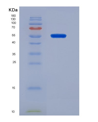 SDS-PAGE analysis of Mouse Fh (Fumarate Hydratase, Mitochondrial) - Recombinant Protein, showing >90% purity under 15% SDS-PAGE (Reduced)