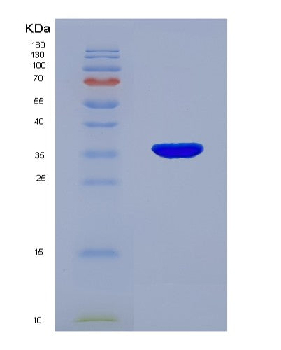 SDS-PAGE analysis of Human EP300 (Histone Acetyltransferase P300) - Recombinant Protein, showing >90% purity under 15% SDS-PAGE (Reduced)