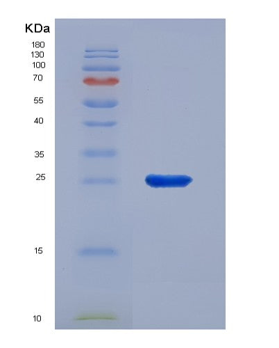 SDS-PAGE analysis of Human PTGER4 (Prostaglandin E2 Receptor Ep4 Subtype) - Recombinant Protein, showing >90% purity under 15% SDS-PAGE (Reduced)
