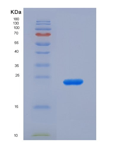 SDS-PAGE analysis of Human SIGLEC12 (Sialic Acid-Binding Ig-Like Lectin 12) - Recombinant Protein, showing >90% purity under 15% SDS-PAGE (Reduced)