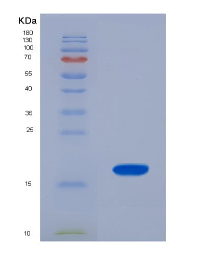 SDS-PAGE analysis of Human UBA52 (Ubiquitin-Ribosomal Protein El40 Fusion Protein) - Recombinant Protein, showing >90% purity under 15% SDS-PAGE (Reduced)