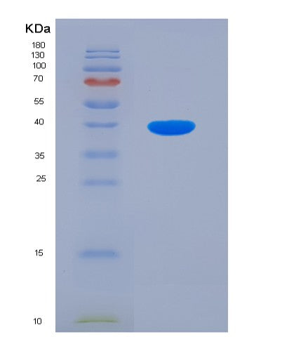 SDS-PAGE analysis of Mouse Adrb2 (Beta-2 Adrenergic Receptor) - Recombinant Protein, showing >90% purity under 15% SDS-PAGE (Reduced)
