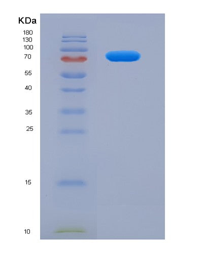 SDS-PAGE analysis of Human ALOX5 (Polyunsaturated Fatty Acid 5-Lipoxygenase) - Recombinant Protein, showing >90% purity under 15% SDS-PAGE (Reduced)