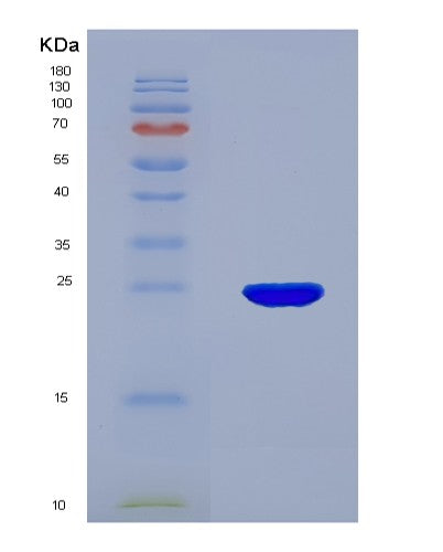 SDS-PAGE analysis of Mouse Cdo1 (Cysteine Dioxygenase Type 1) - Recombinant Protein, showing >90% purity under 15% SDS-PAGE (Reduced)