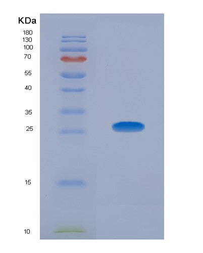 SDS-PAGE analysis of Human CDK5 (Cyclin-Dependent Kinase 5) - Recombinant Protein, showing >85% purity under 15% SDS-PAGE (Reduced)