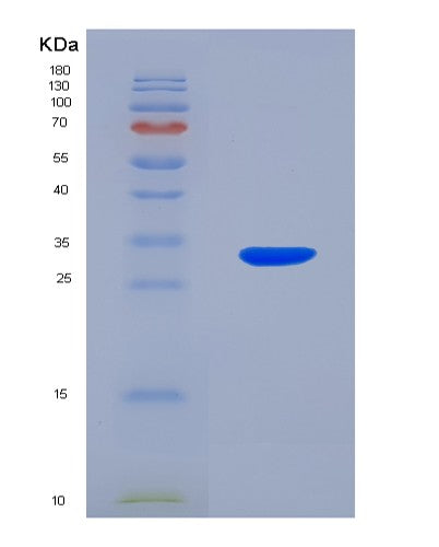 SDS-PAGE analysis of Human COPS5 (Cop9 Signalosome Complex Subunit 5) - Recombinant Protein, showing >90% purity under 15% SDS-PAGE (Reduced)