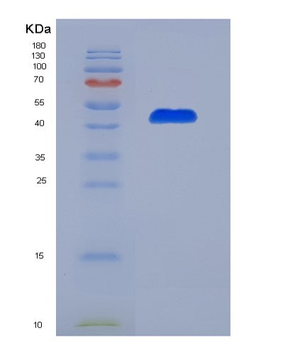 SDS-PAGE analysis of Human WWP2 (Nedd4-Like E3 Ubiquitin-Protein Ligase Wwp2) - Recombinant Protein, showing >90% purity under 15% SDS-PAGE (Reduced)