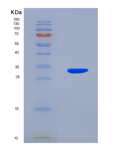 SDS-PAGE analysis of Human SIRT5 (Nad-Dependent Protein Deacylase Sirtuin-5, Mitochondrial) - Recombinant Protein, showing >90% purity under 15% SDS-PAGE (Reduced)