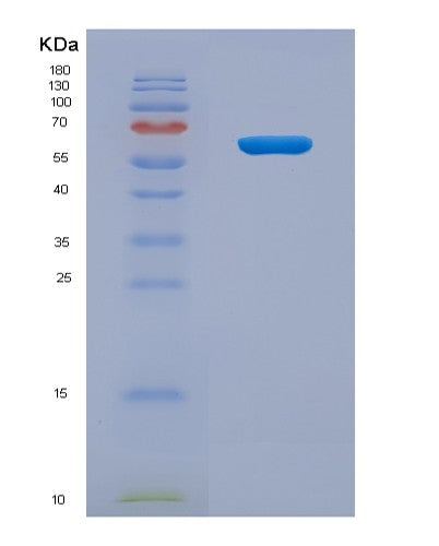 SDS-PAGE analysis of Human HJV (Hemojuvelin) - Recombinant Protein, showing >90% purity under 15% SDS-PAGE (Reduced)