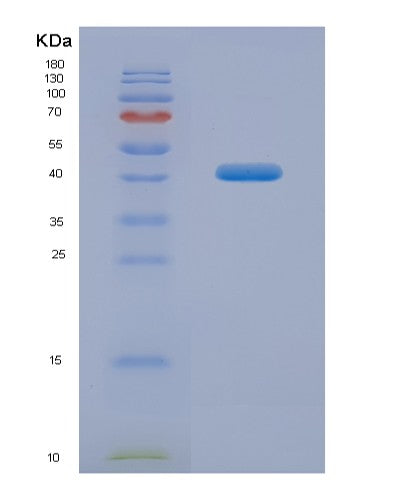 SDS-PAGE analysis of Human MFN1 (Mitofusin-1) - Recombinant Protein, showing >90% purity under 15% SDS-PAGE (Reduced)