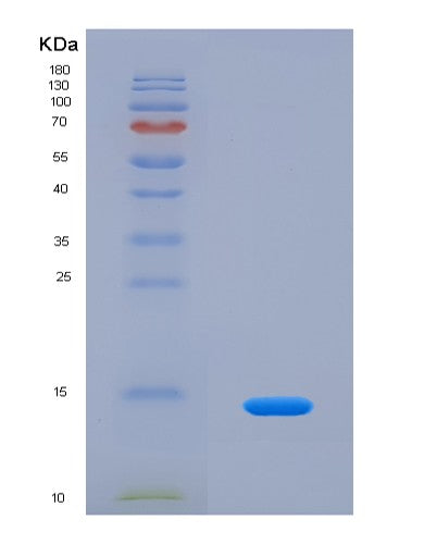SDS-PAGE analysis of Mouse C5 (Complement C5) - Recombinant Protein, showing >90% purity under 15% SDS-PAGE (Reduced)