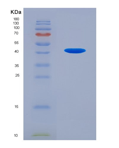 SDS-PAGE analysis of Human C4A (Complement C4-A) - Recombinant Protein, showing >90% purity under 15% SDS-PAGE (Reduced)