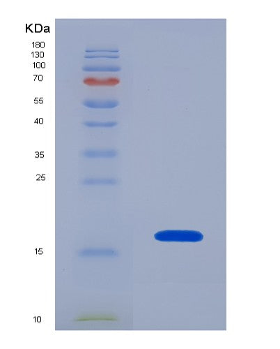 SDS-PAGE analysis of Human PDGFD (Platelet-Derived Growth Factor D) - Recombinant Protein, showing >90% purity under 15% SDS-PAGE (Reduced)
