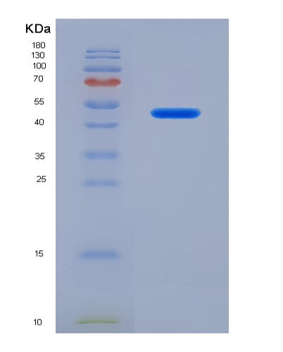 SDS-PAGE analysis of Human SIGLEC7 (Sialic Acid-Binding Ig-Like Lectin 7) - Recombinant Protein, showing >90% purity under 15% SDS-PAGE (Reduced)