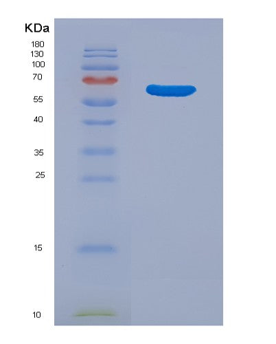 SDS-PAGE analysis of Human TGM1 (Protein-Glutamine Gamma-Glutamyltransferase K) - Recombinant Protein, showing >90% purity under 15% SDS-PAGE (Reduced)